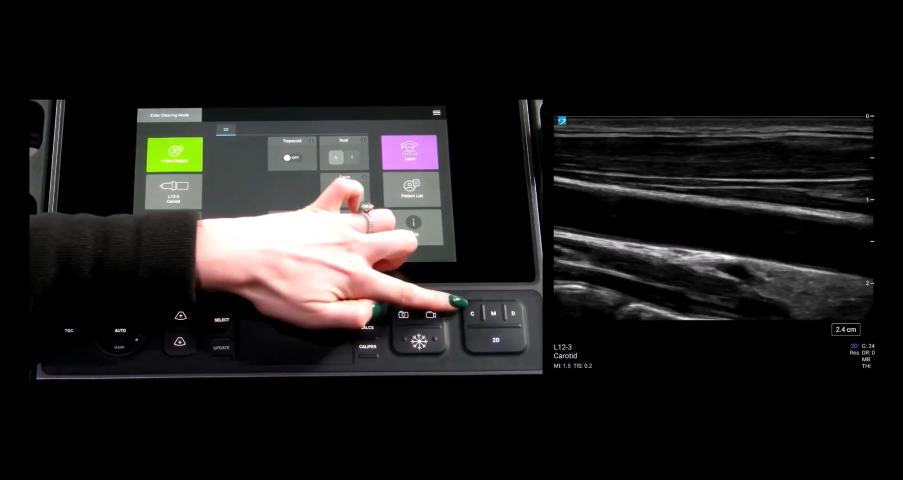 Picture of finger pointing at the correct button for color doppler activation