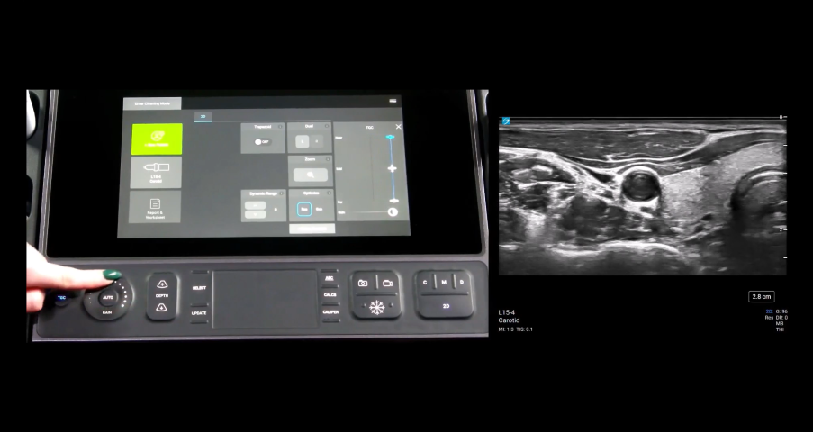 Picture of sonosite px interface for the gains and depth feature