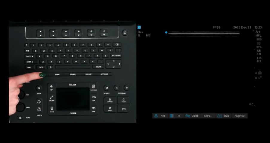 Picture of Sonosite Edge 2 with finger pointing in general place of the interface.