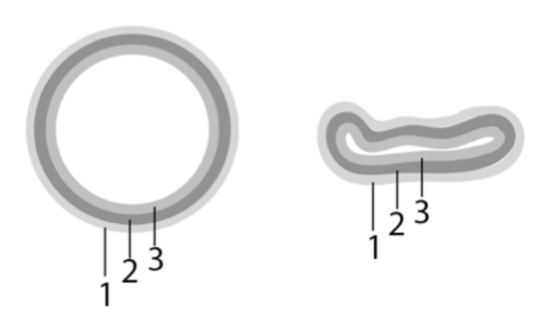 Venous Collapsibility (numbered)