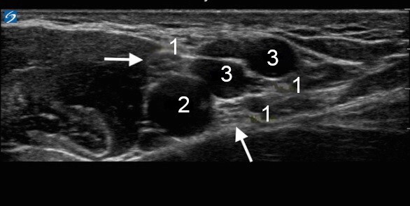 Axillary Vessels