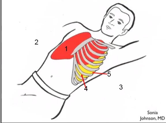 Patient Position Lateral Approach