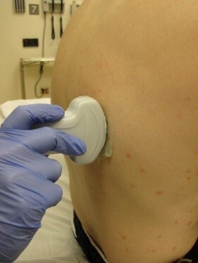 Transducer Position Posterior Approach
